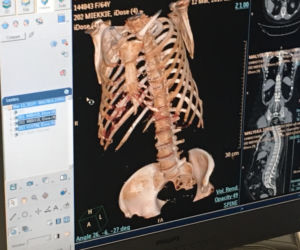 Nowy sprzęt w szpitalu MSWiA w Lublinie. Pomoże zdiagnozować pacjentów