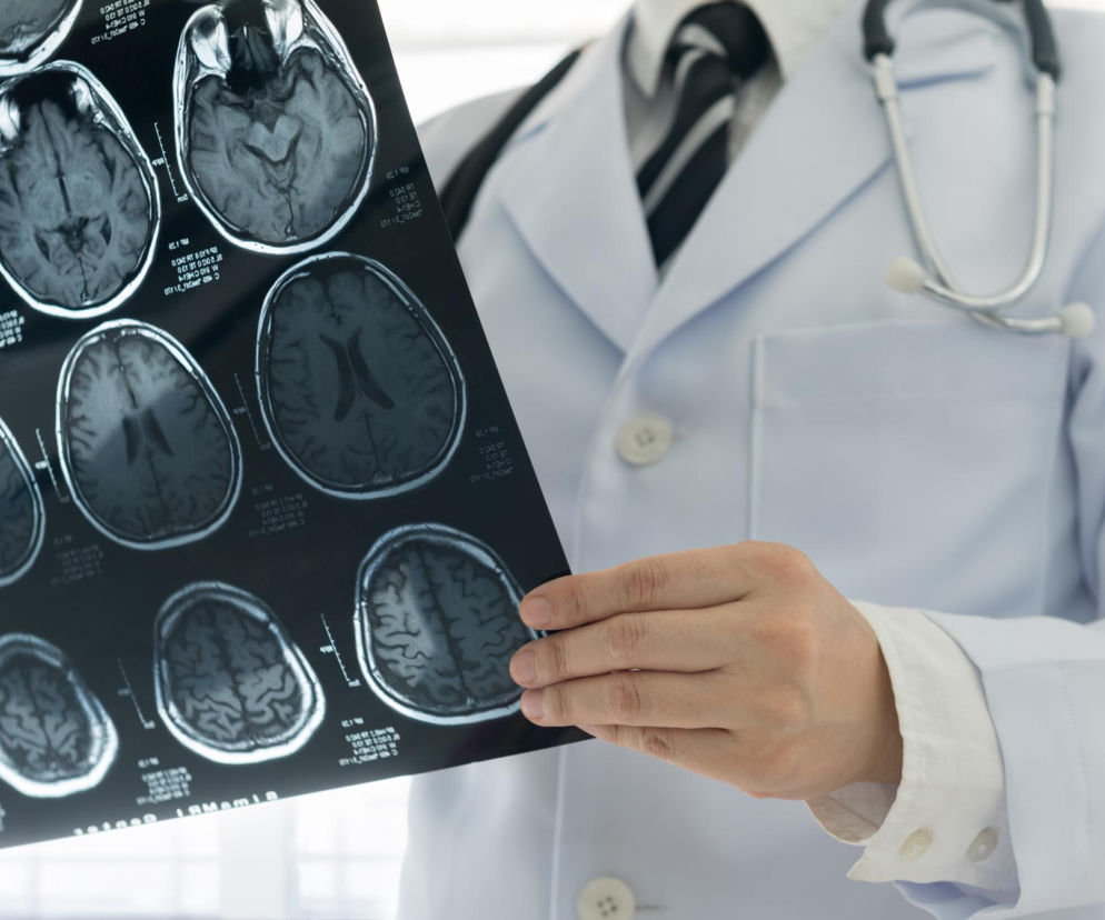 Lekarz w białym kitlu i ze stetoskopem trzyma kliszę z rezonansem magnetycznym mózgu, analizując jego struktury. Obrazowanie MRI jest kluczowe w diagnostyce autoimmunologicznego zapalenia mózgu, o czym przeczytasz więcej na Poradnik Zdrowie.