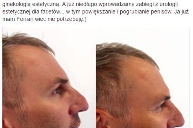Krzysztof Gojdź o przedłużaniu penisa