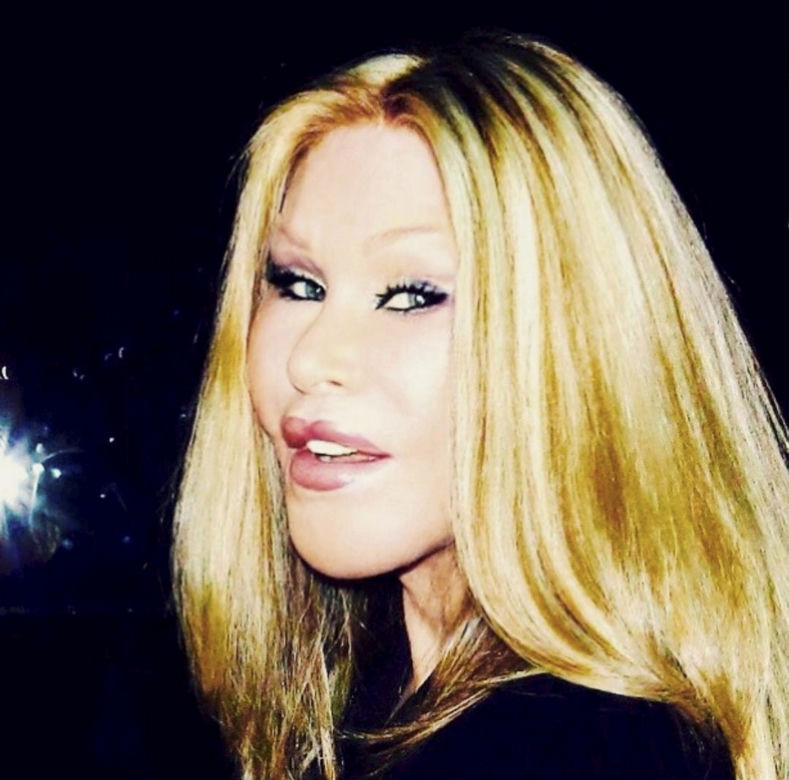 Kobieta kot szokuje na Instagramie! Jocelyn Wildestein zrobiła retusz wszech czasów 