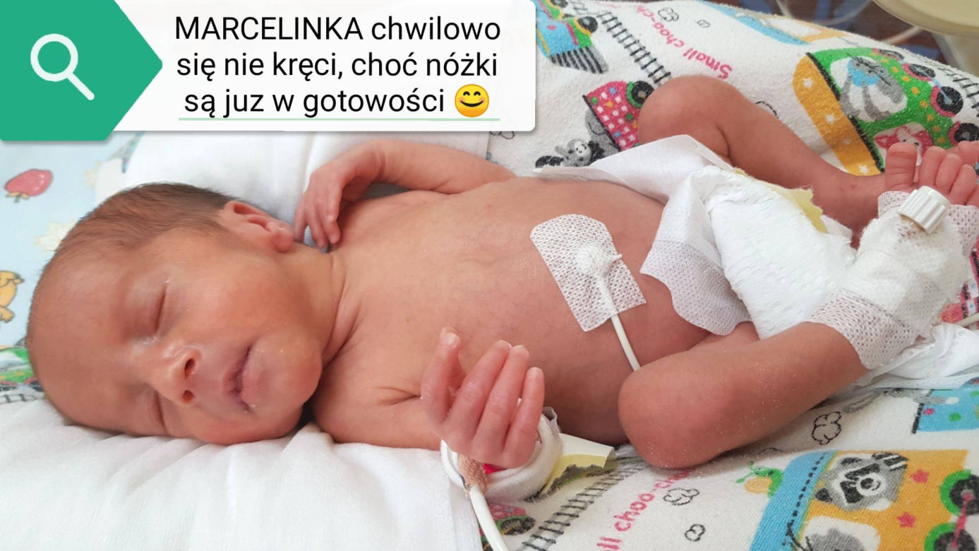 Czworaczki z Bydgoszczy urodziły się 3.03.2020