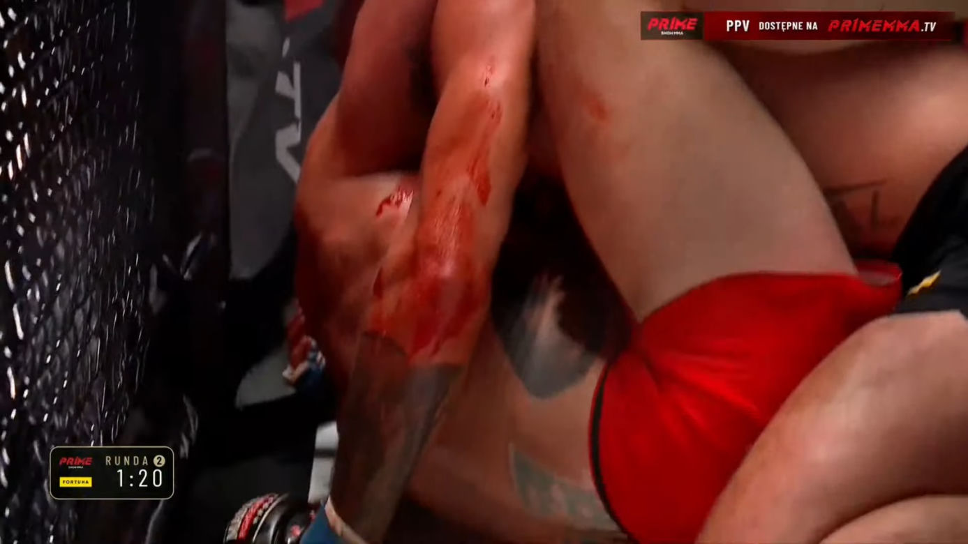 Krwawa rzeź w walce na PRIME MMA