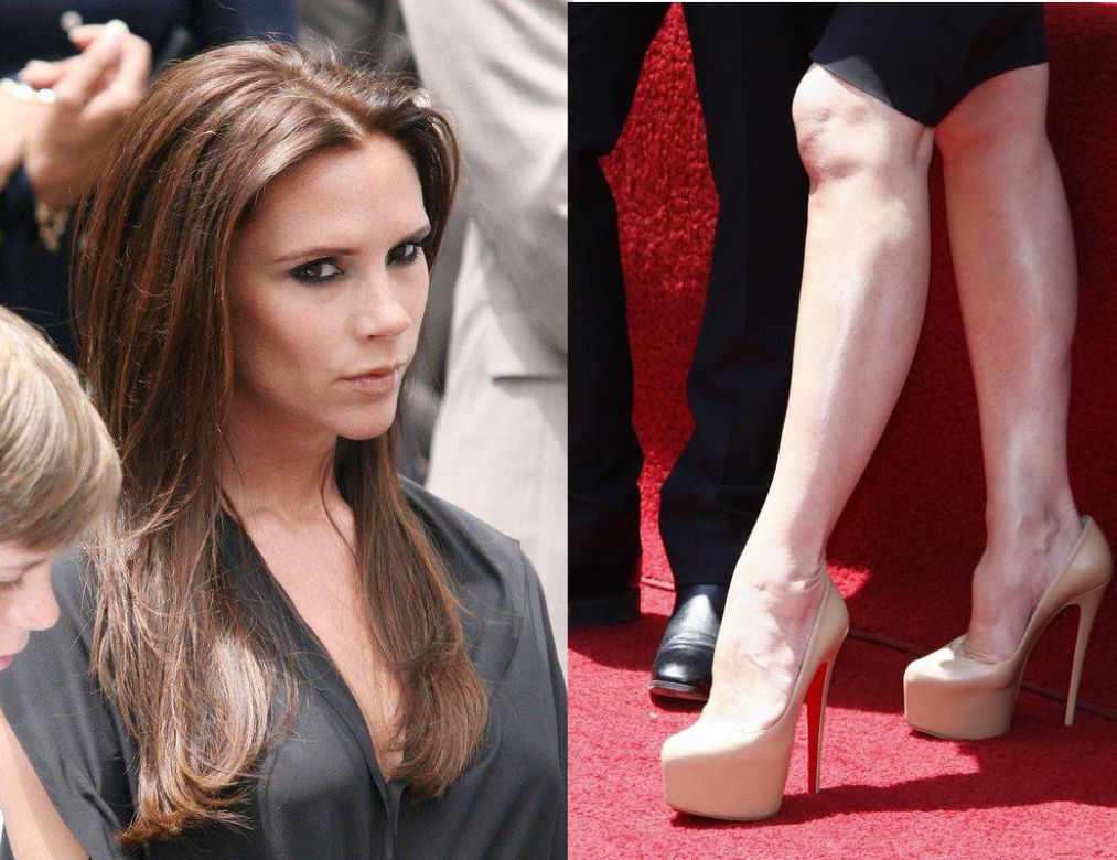 Victoria Beckham