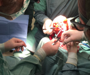 Lekarze przyszyli palec od nogi w miejsce kciuka