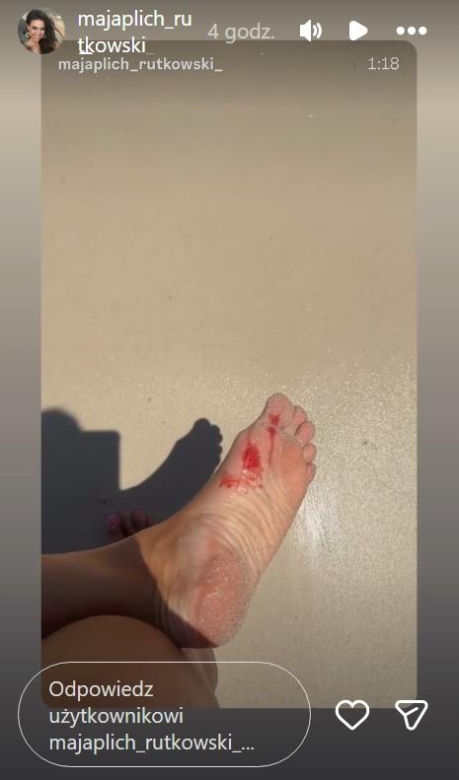 Maja Rutkowski miała wypadek w Tajlandii! Polała się krew!