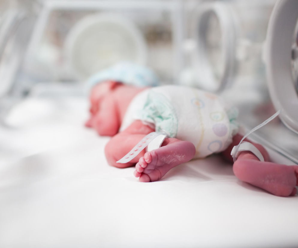 Noworodek leżący w inkubatorze, z przyczepionymi elektrodami do nóżek. Zdjęcie symbolizuje walkę o życie i przeszczep serca u niemowlęcia Ignacego, o czym przeczytasz więcej na Poradnik Zdrowie.