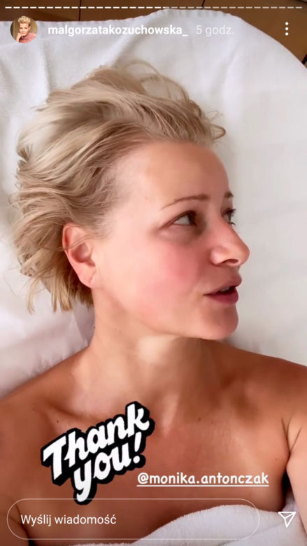Małgorzata Kożuchowska podniosła policzki i wygładziła czoło