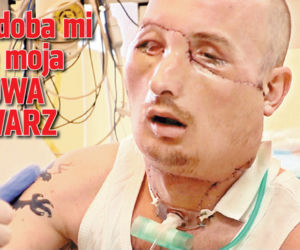 Podoba mi się moja nowa twarz
