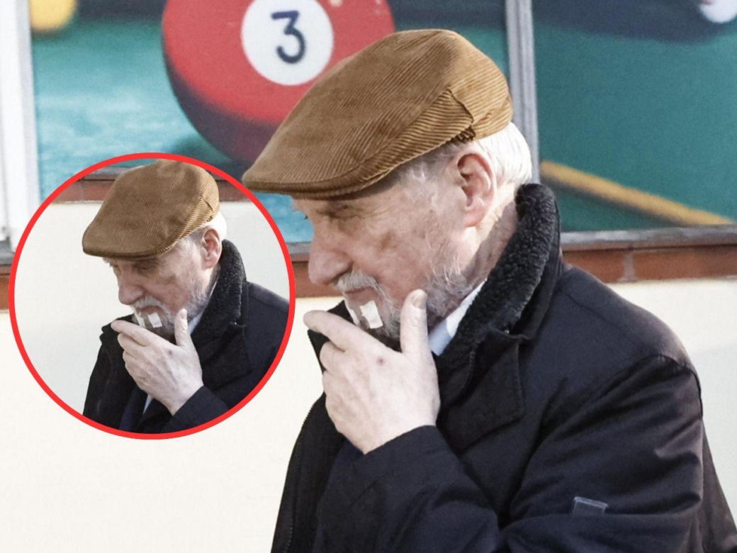 Macierewicz z plastrami na brodzie
