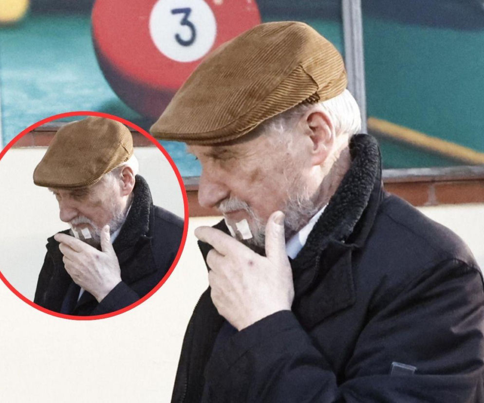 Macierewicz z plastrami na brodzie