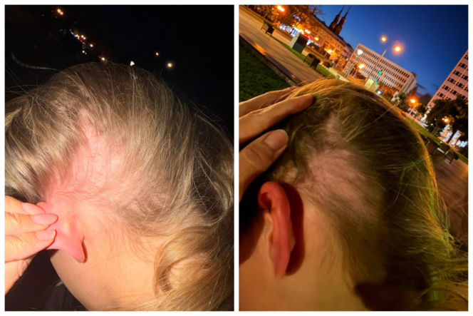 13-letnia Ukrainka została zaatakowana w centrum Siedlec! Pijana 41-letnia Polka zastosowała słowną i fizyczną przemoc wobec dziewczynki