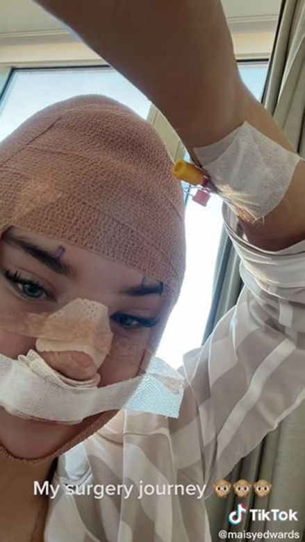 Znana influencerka pojechała do Turcji "zrobić" sobie nos. Wydała 50 tys. zł, fani bezlitośni: "Jest gorzej"