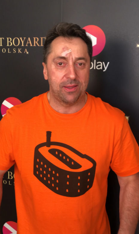 Marcin Miller oberwał w czoło