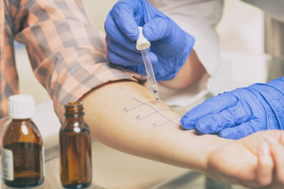 Metody diagnozowania reakcji krzyżowych