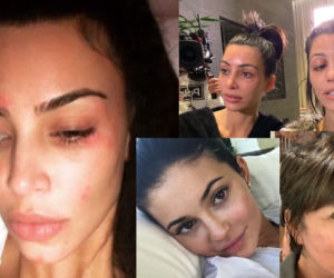 Kardashianki bez makijażu