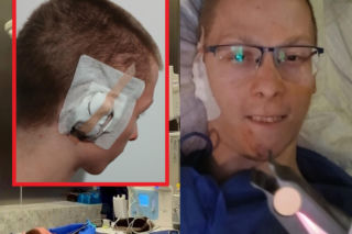 Kamil po latach walki ma nowe ucho. Nikt na świecie nie chciał się podjąć operacji