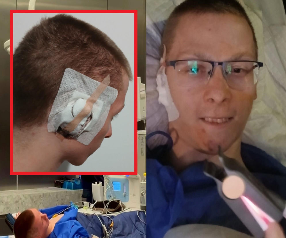 Kamil po latach walki ma nowe ucho. Nikt na świecie nie chciał się podjąć operacji