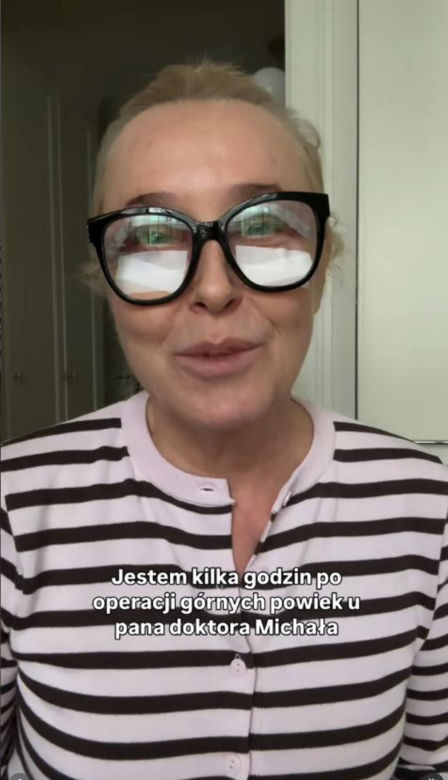 Agata Młynarska wycięła sobie powieki