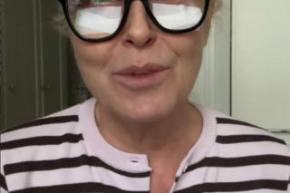 Agata Młynarska wycięła sobie powieki