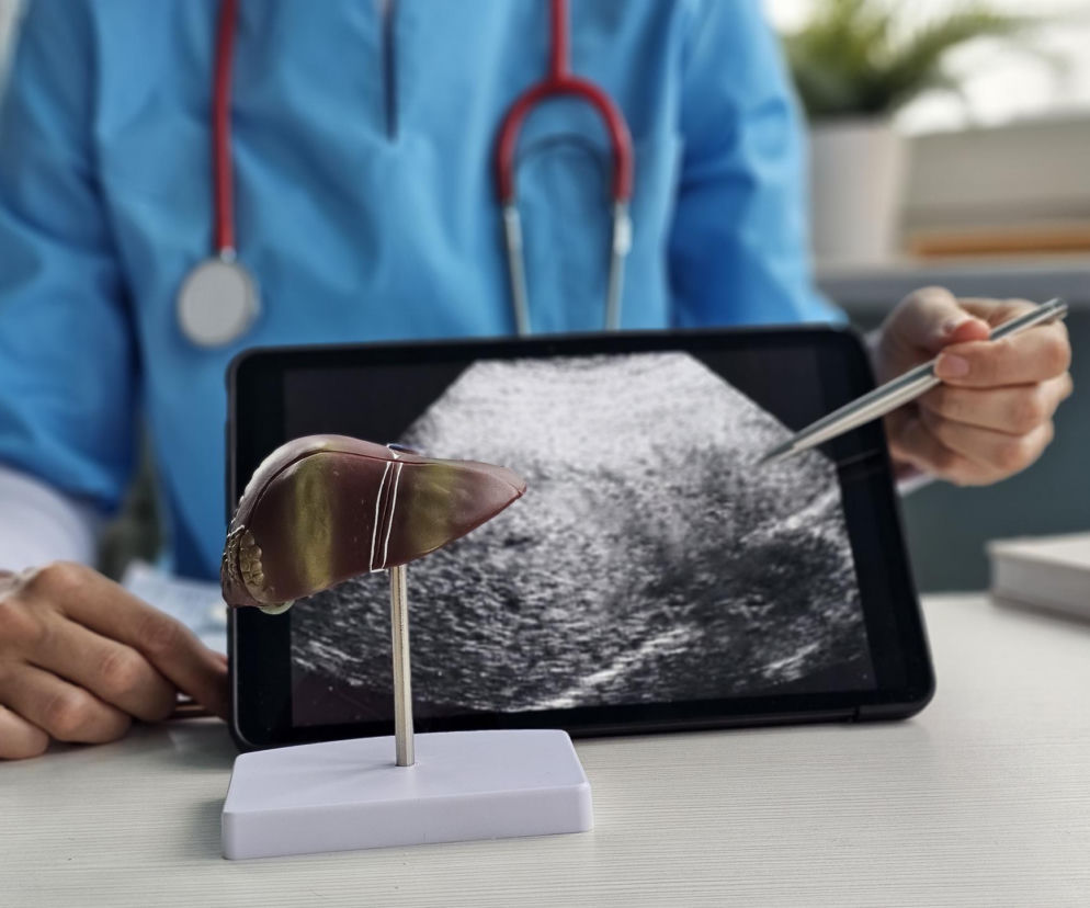 USG wykazało zmianę w wątrobie? Chirurg onkolog tłumaczy