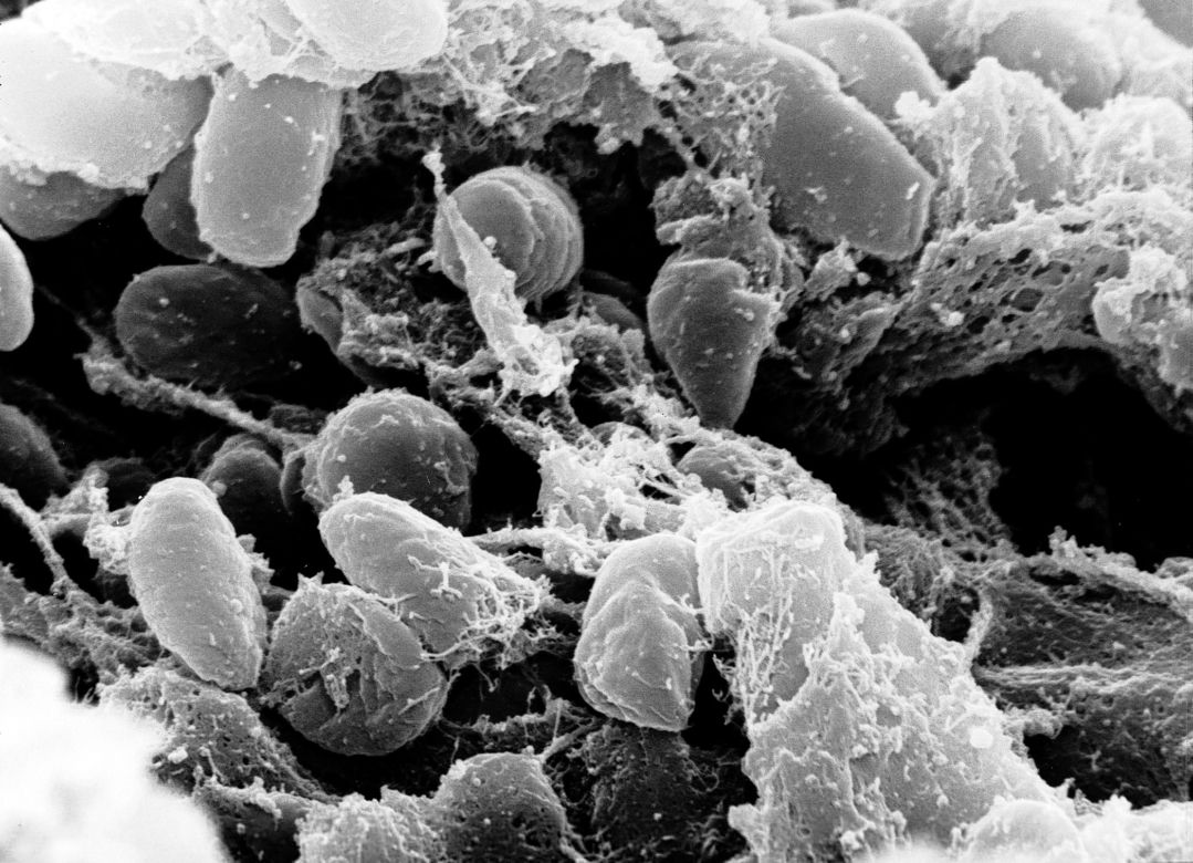 Dżuma, cholera, ptasia grypa, a teraz Covid-19. Jak kiedyś radzono sobie z epidemią?