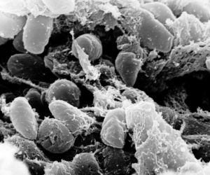 Dżuma, cholera, ptasia grypa, a teraz Covid-19. Jak kiedyś radzono sobie z epidemią?