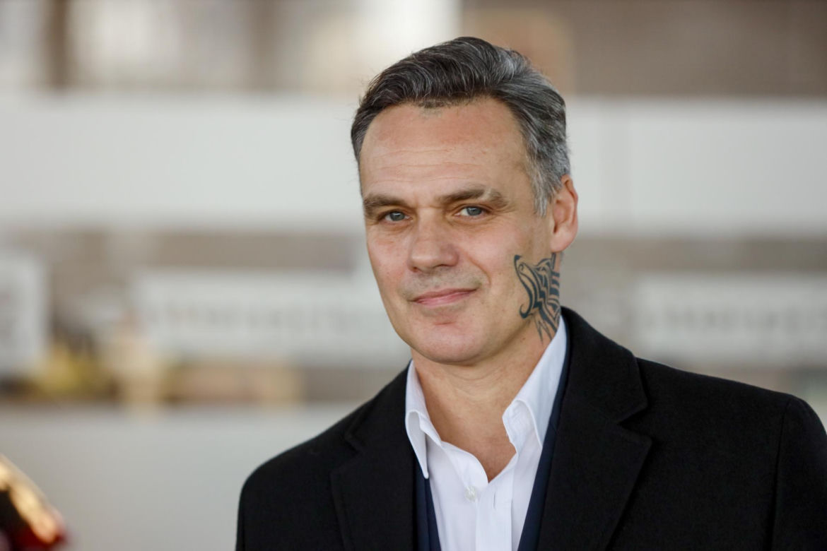 Jan Wieczorkowski przed przeszczepem włosów