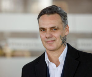 Jan Wieczorkowski przed przeszczepem włosów