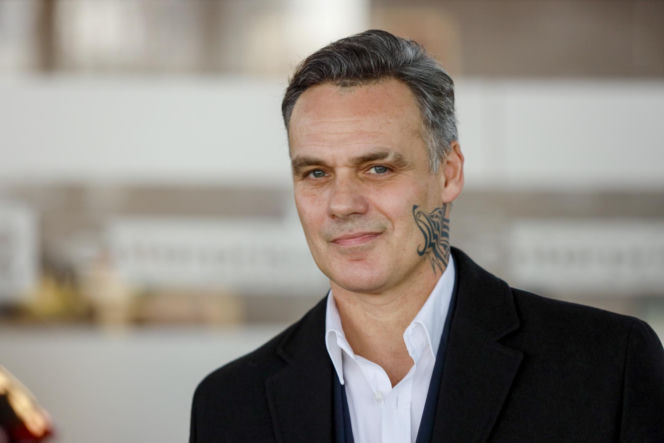 Jan Wieczorkowski przed przeszczepem włosów