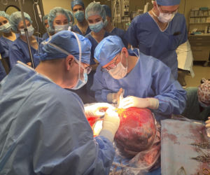 Wyjęli wątrobę, „naprawili” ją i wszczepili z powrotem. 8-kilogramowy guz był śmiertelnym zagrożeniem