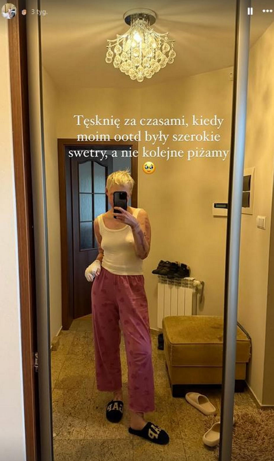 Maja Kuczyńska przeżyła piekło. Całe ciało w oparzeniach