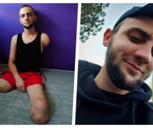 Sosnowiec: Igor stracił nogi i rękę. Dzięki ludziom dostał pierwsze protezy 