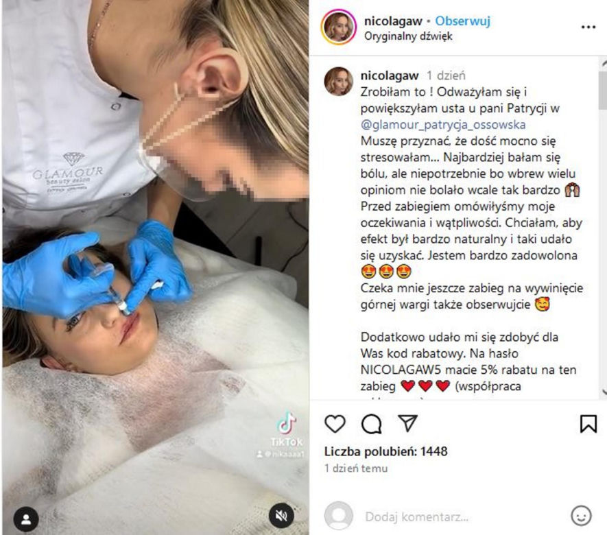 Nicola z "Rolnik szuka żony" powiększyła sobie usta
