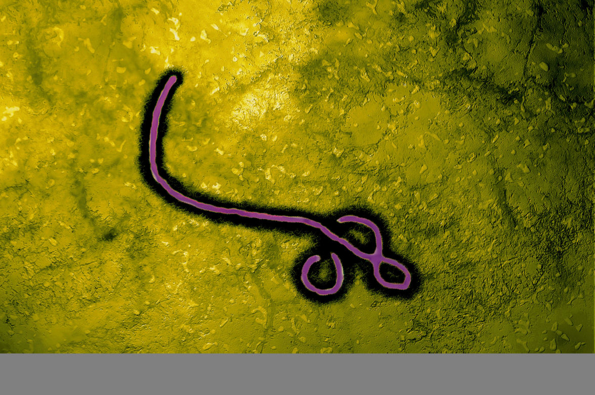 Ebola w Polsce ?