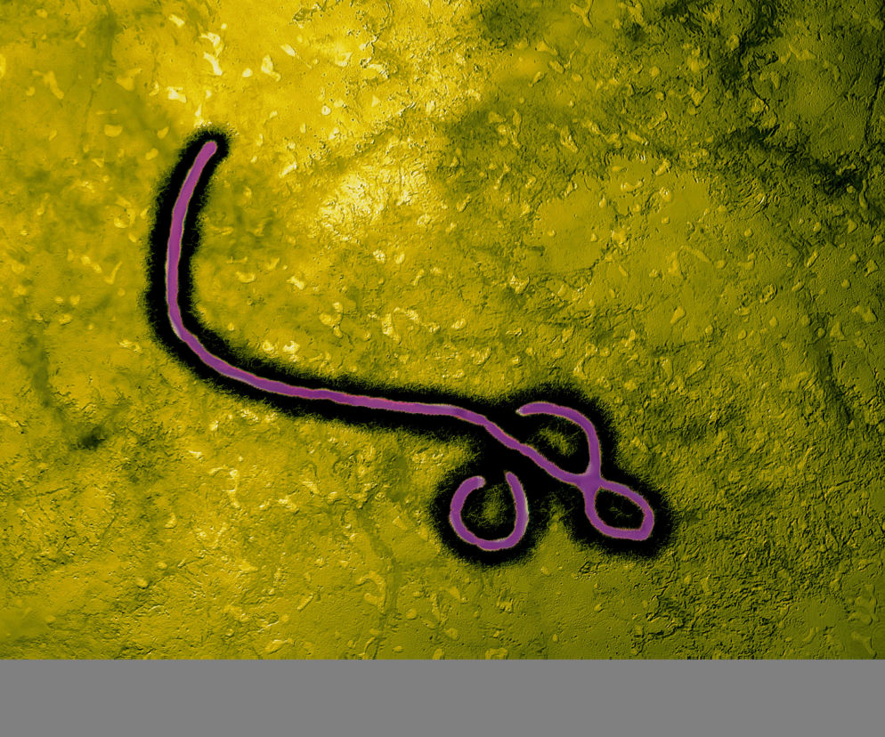 Ebola w Polsce ?