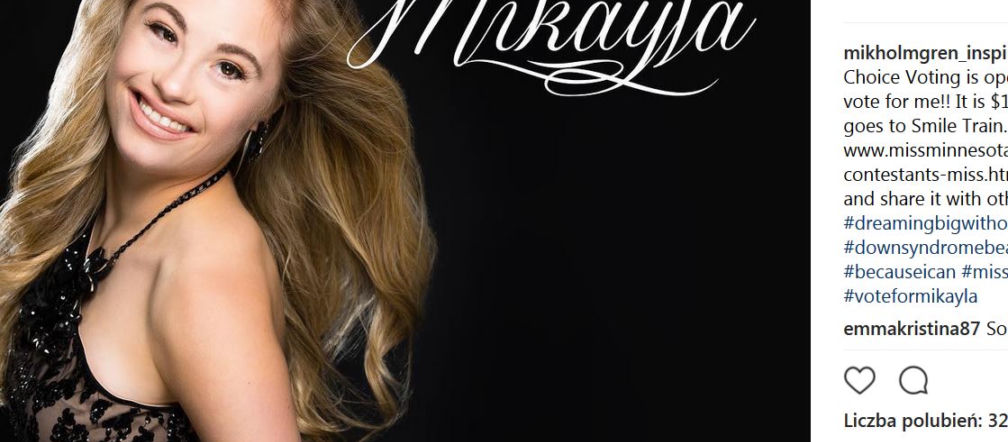 Pierwsza kobieta z zespołem Downa w konkursie miss piękności
