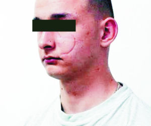CZŁOWIEK Z BLIZNĄ ZŁAPANY W ANGLII
