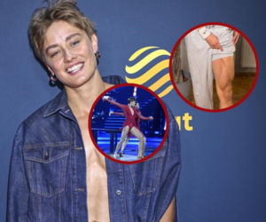 Katarzyna Zillmann pokazała napięte przepotężne udo! Wcześniej odsłoniła spory kawał biustu