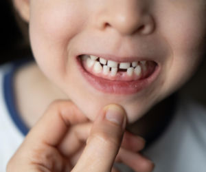 Chrapanie, bóle głowy, garbienie się? Lepiej sprawdź zgryz dziecka