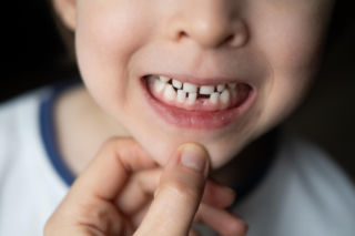 Chrapanie, bóle głowy, garbienie się? Lepiej sprawdź zgryz dziecka