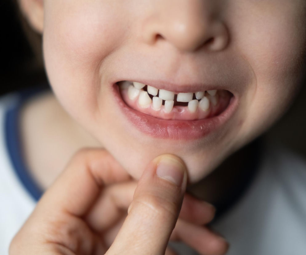 Chrapanie, bóle głowy, garbienie się? Lepiej sprawdź zgryz dziecka