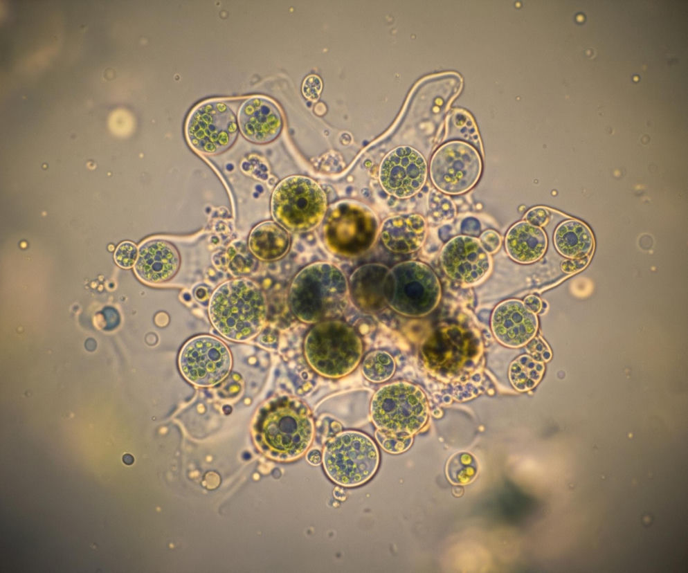 Centralnym elementem obrazu jest duży, nieregularny organizm o zmiennym kształcie, składający się z licznych, kulistych struktur. Większość tych struktur to pęcherzyki o jasnozielonej barwie, wypełnione ciemniejszymi, małymi, kulistymi inkluzjami. Niektóre z nich są bardziej żółto-zielone i wydają się być gęściej wypełnione. Całość ma prześwitującą, beżowo-szarą otoczkę, która rozciąga się w postaci pseudopodiów, a na jej powierzchni widać mniejsze, pojedyncze pęcherzyki. Tło jest jasne, beżowo-szare, z licznymi rozproszonymi małymi punktami i delikatnymi ciałkami, a krawędzie kadru są wyraźnie ciemniejsze, tworząc winietę.