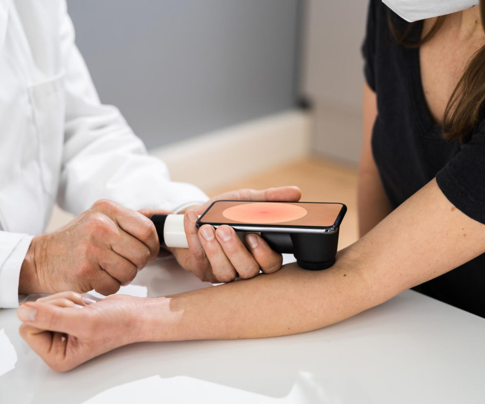 Lekarz dermatolog w białym kitlu, z bliska, bada znamię na przedramieniu pacjentki za pomocą dermatoskopu połączonego ze smartfonem, który wyświetla powiększony obraz pieprzyka. Kobieta ma na sobie czarną koszulkę i białą maseczkę ochronną. Regularne badanie znamion jest kluczowe, o czym przeczytasz na Poradniku Zdrowie.