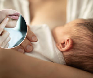 Opryszczka u dziecka: objawy, przyczyny i jak nie zarazić domowników