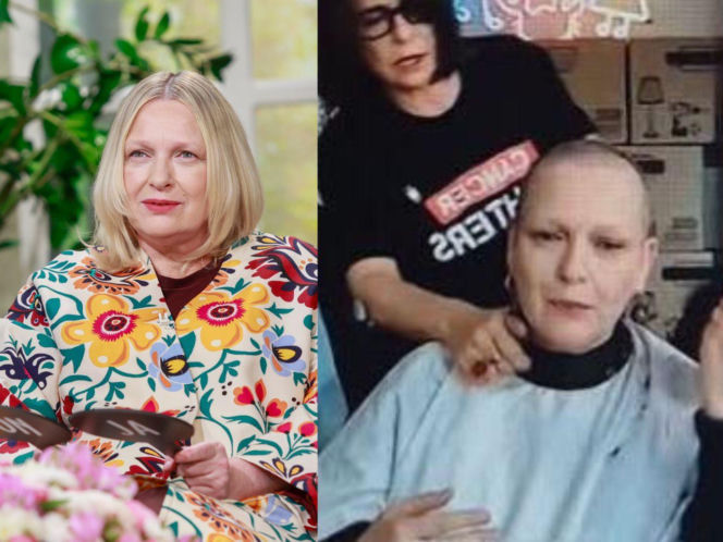 Gwiazdy zgoliły włosy w szczytnym celu