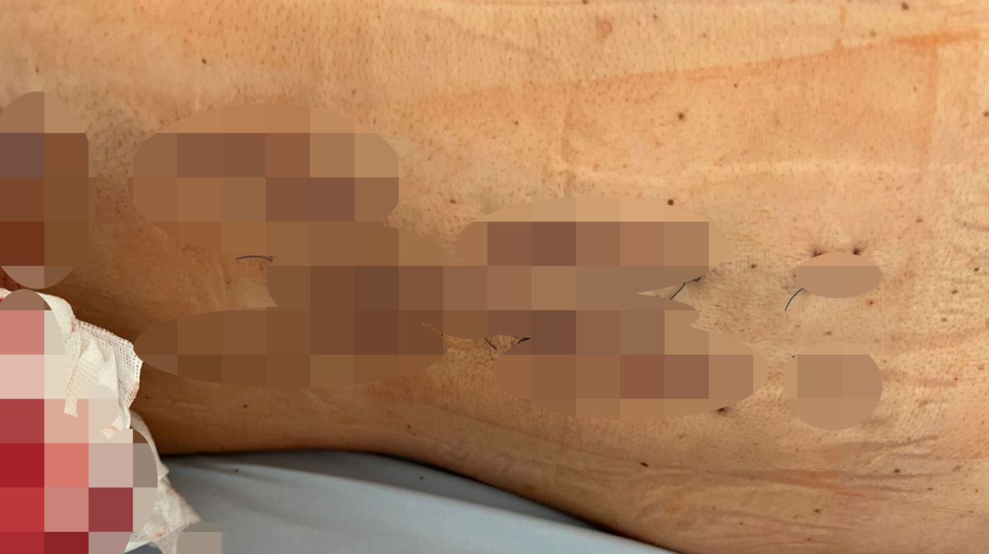 Znana influenserka dziękuję strażakom za uratowanie życia. Mia Tattoo została ciężko ranna w wypadku pod Zieloną Górą