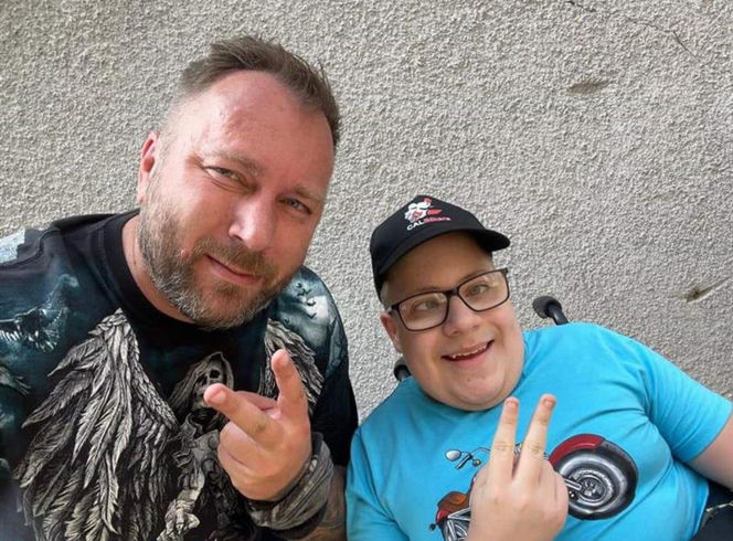 Gabryś przeszedł 17 operacji, tylko na twarzy i dłoniach nie ma blizn. Jego pają jest pomoc innym!