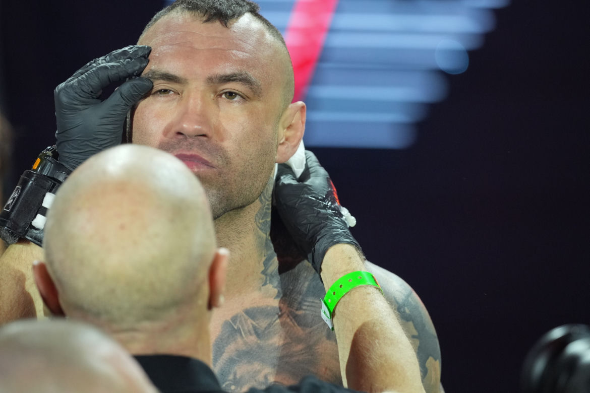Paczuski: Potworne rozcięcie na twarzy gwiazdy KSW