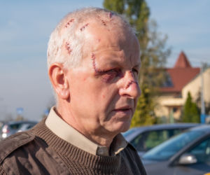 15-latek zmasakrował taksówkarza