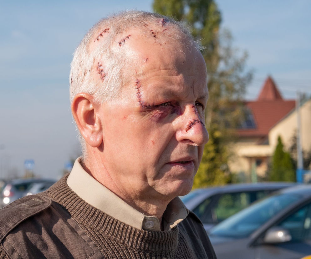 15-latek zmasakrował taksówkarza